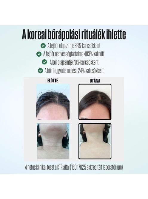 POSEION BT100® Prémium koreai revitalizáló zuhanyfej vízszűrővel, mágneses-ionizáló technológiával, szürke